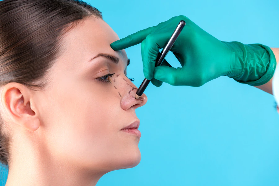 Czy można usunąć garbek nosowy za pomocą operacji plastycznej nosa?