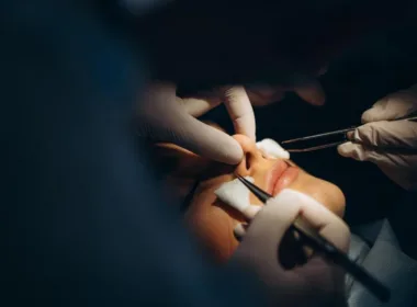 Jak przygotować się do operacji plastycznej korekcji przegrody nosowej